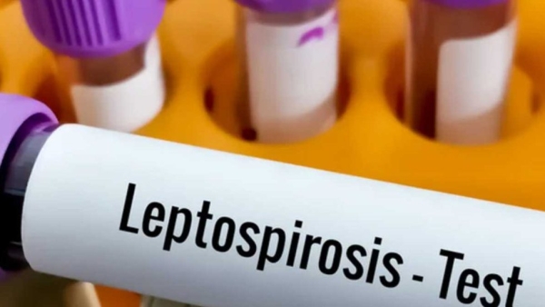 Bell Ville: Se confirmó un fallecido por leptospirosis y se refuerzan las medidas sanitarias