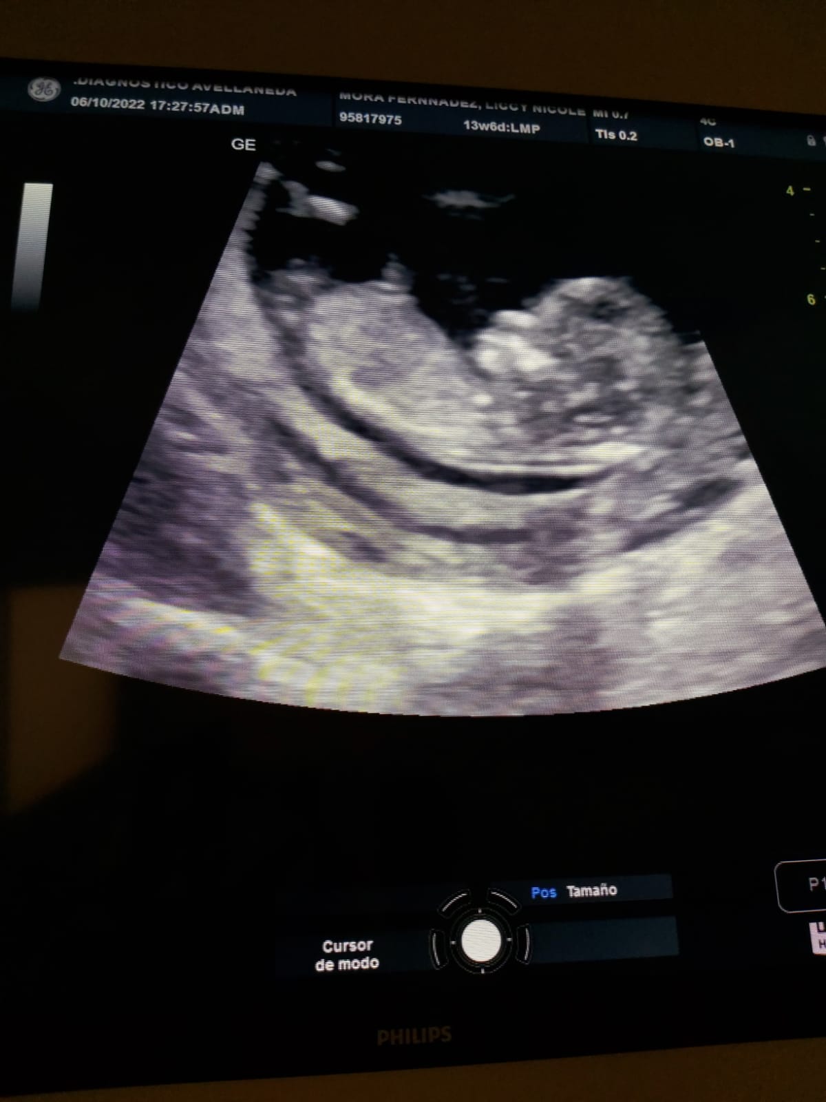 Jesús Chacón sobre Venezuela: “Siempre uno quiere volver por más que necesite estar estable”